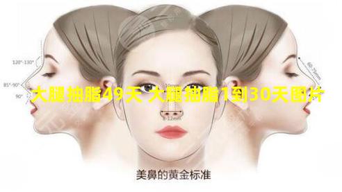 大腿抽脂49天 大腿抽脂1到30天图片